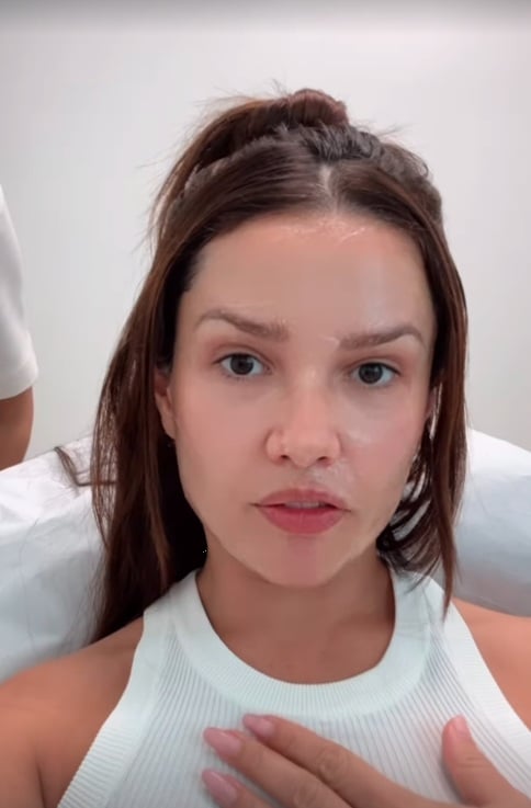 Juliette fez uma série de procedimentos estéticos por Reprodução/Instagram