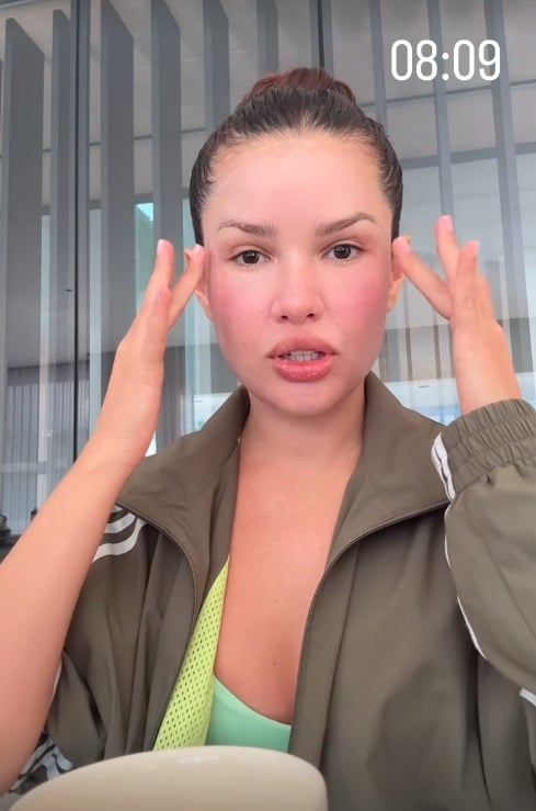Juliette mostra inchaço no rosto após procedimento estético com esperma de salmão por Reprodução/Instagram