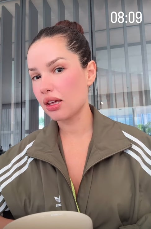 Juliette mostra inchaço no rosto após procedimento estético com esperma de salmão por Reprodução/Instagram