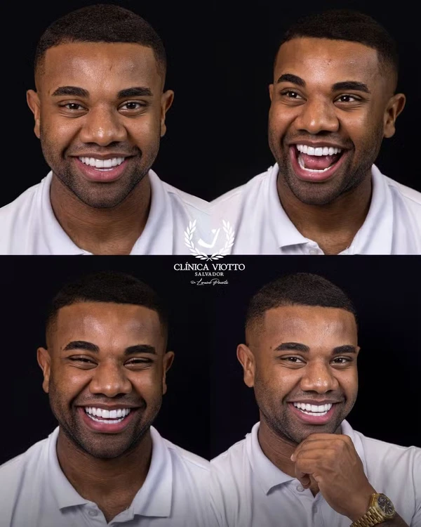 Antes e Depoi por Divulgação