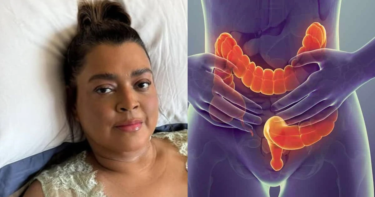 Imagem - Câncer que matou Preta Gil: como prevenir, reconhecer os sintomas e quando procurar um médico