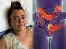 Imagem - Câncer que matou Preta Gil: como prevenir, reconhecer os sintomas e quando procurar um médico