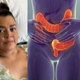 Imagem - Câncer que matou Preta Gil: como prevenir, reconhecer os sintomas e quando procurar um médico