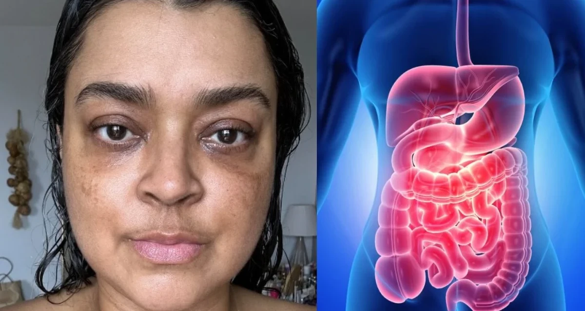 Preta Gil morreu vítima de câncer colorretal por Reprodução