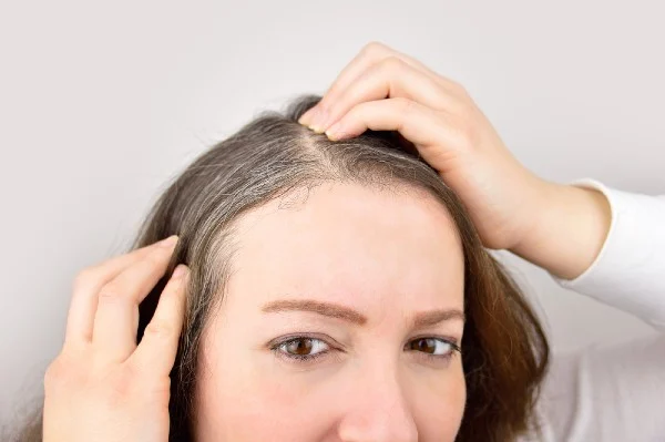 A ausência de amônia e oxidantes faz do shampoo tonalizante uma opção segura para cabelos sensibilizados por Shutterstock