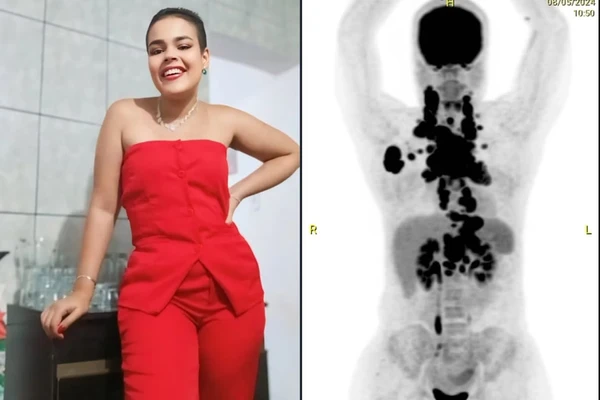 Rafaela Ribeiro descobriu câncer por ser insistente por Reprodução