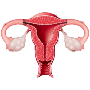 Endometriose por Shutterstock