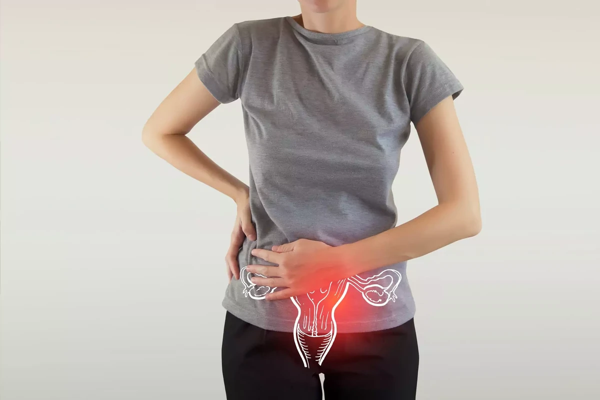 Endometriose por Shutterstock