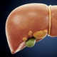 Imagem - Gordura no fígado pode causar câncer e levar à morte; veja sintomas, causas e como prevenir