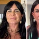 Imagem - Gretchen surpreende ao mostrar 'novo rosto' após procedimento