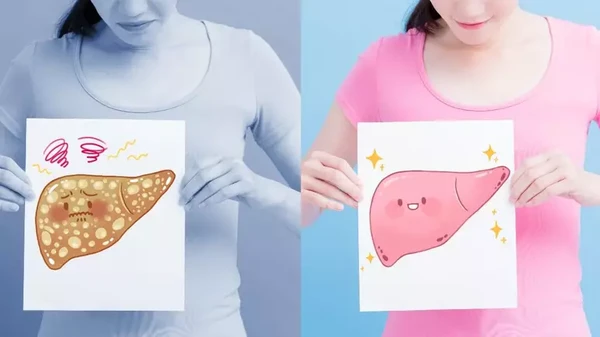 Gordura no fígado pode ser grave por Shutterstock