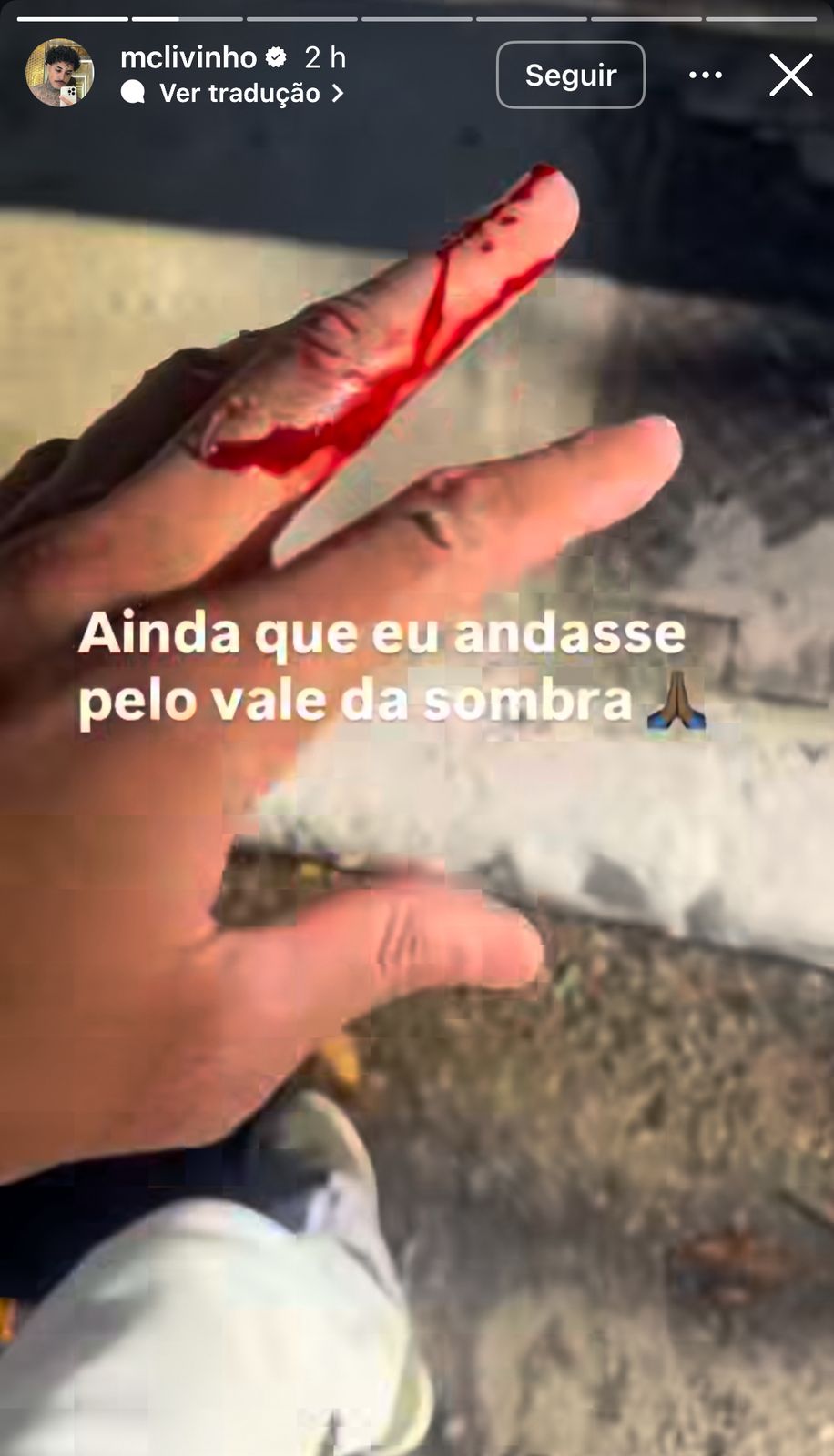 MC Livinho sofre acidente por Reprodução / Instagram