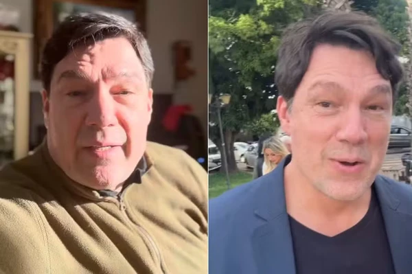 Ricardo Macchi antes e depois da harmonização facial por Reprodução
