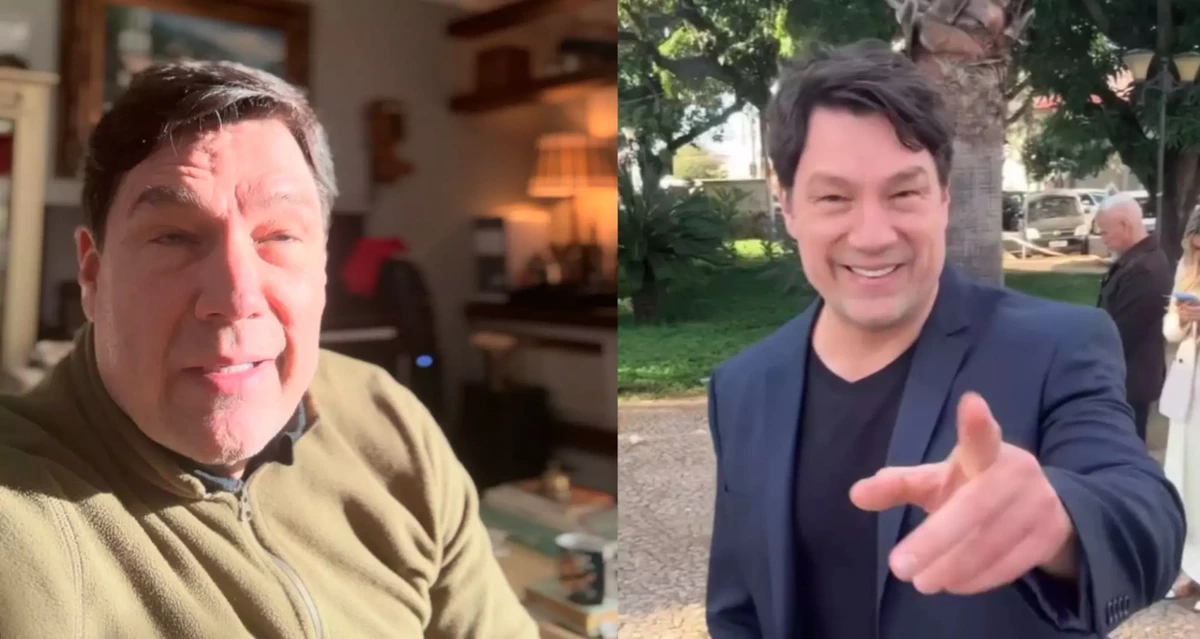 Ricardo Macchi antes e depois da harmonização facial por Reprodução