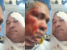 Imagem - Rodoviário é agredido com martelada na cabeça em Salvador