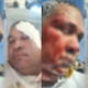 Imagem - Rodoviário é agredido com martelada na cabeça em Salvador
