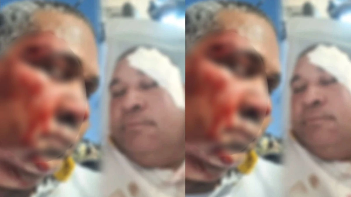 Agressão ocorreu na Baixa do Fiscal