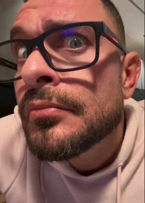 Diogo Nogueira chama atenção após transplante capilar por Reprodução/Instagram