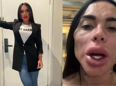 Imagem - Eterno 'Cigano Igor' e +: veja antes e depois de famosos que fizeram harmonização facial