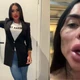 Imagem - Eterno 'Cigano Igor' e +: veja antes e depois de famosos que fizeram harmonização facial