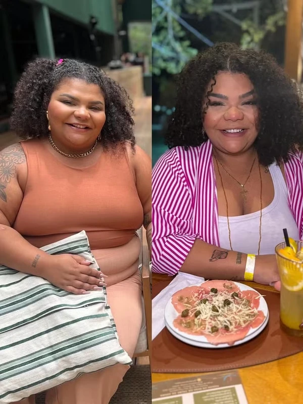 Flora Cruz mostra antes e depois do processo de emagrecimento por Reprodução/Instagram