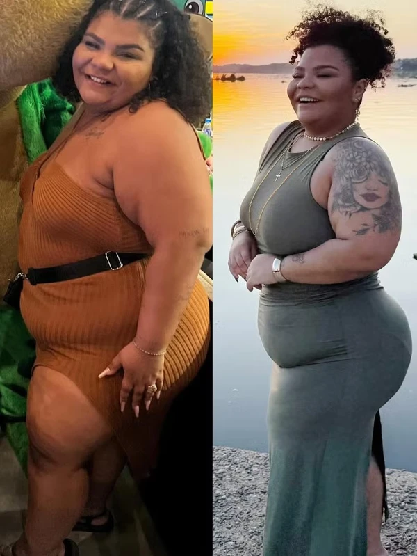 Flora Cruz mostra antes e depois do processo de emagrecimento por Reprodução/Instagram