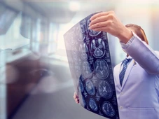 Imagem - Será que você está com um AVC em curso? Veja 5 sintomas que pode estar ignorando