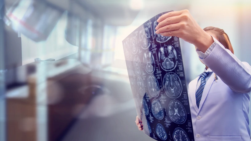Imagem - Será que você está com um AVC em curso? Veja 5 sintomas que pode estar ignorando
