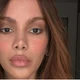 Imagem - Anitta abre o jogo sobre saúde mental: 'Quero estar viva'