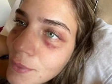 Imagem - Modelo acusa jogador paraguaio de cárcere privado e abuso: ‘Me bateu com luvas de boxe’