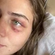 Imagem - Modelo acusa jogador paraguaio de cárcere privado e abuso: ‘Me bateu com luvas de boxe’