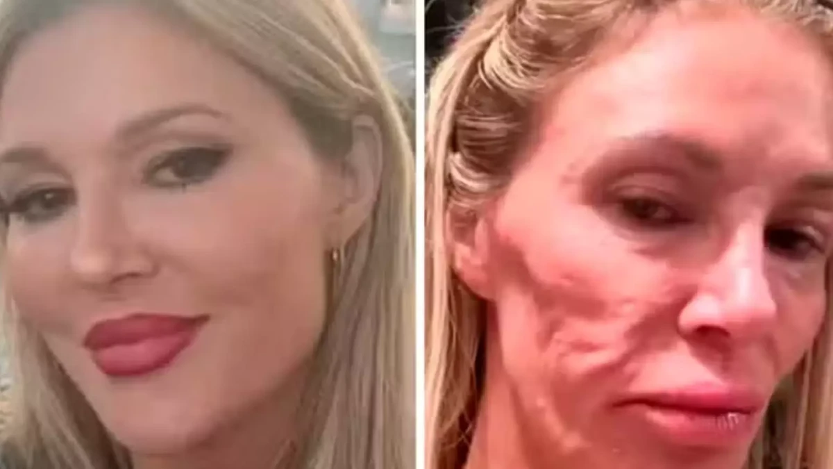 Brandi Glanville antes e depois por Reprodução