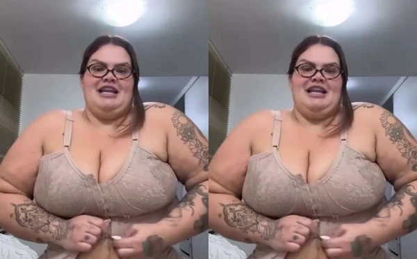 Thais Carla mostra resultado da cirurgia 