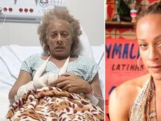 Imagem - Atriz de Ó Paí Ó faz forte relato após ser espancada pelo ex: 'Tentou me sufocar e me matar'