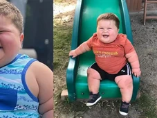 Imagem - Doença rara faz criança de 3 anos pesar 45 kg e chorar de fome o dia inteiro