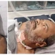 Imagem - Veja quais foram as sequelas enfrentadas por Arlindo Cruz após o AVC hemorrágico