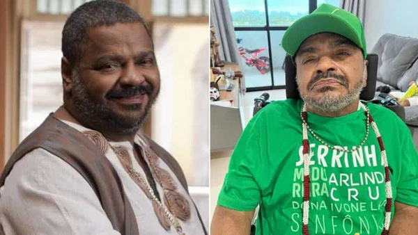 Arlindo Cruz antes e depois do AVC