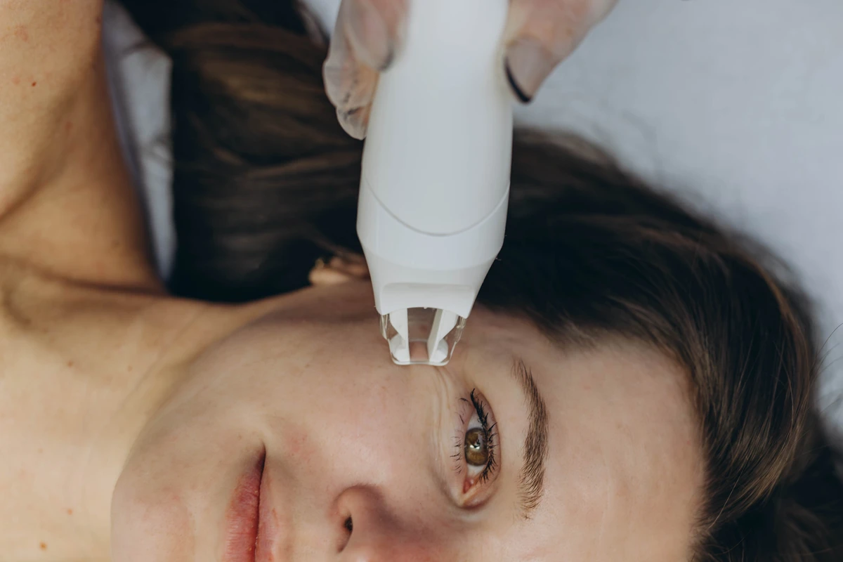 Celulite facial  por Shutterstock