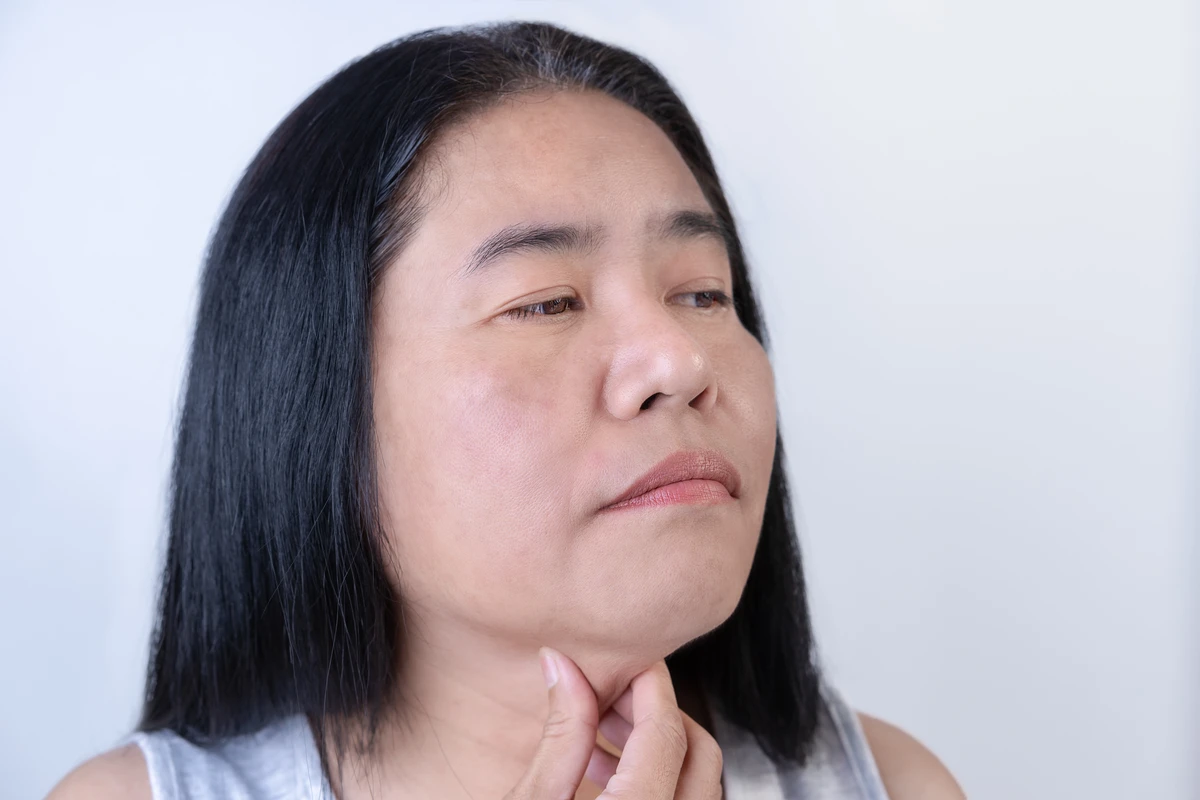Celulite facial 