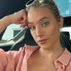 Imagem - Modelo atingida por pombo em acidente revela perda de memória: 'Não consigo lembrar o que fiz ontem'