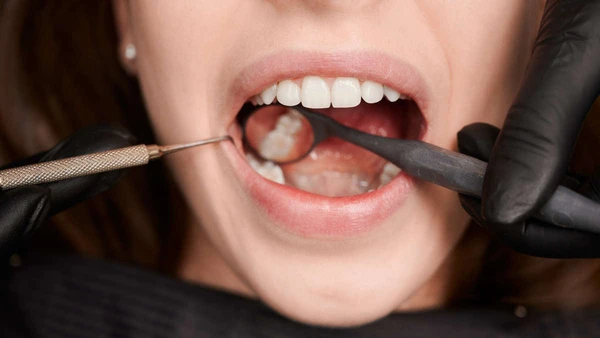 Close-up, cropped snapshot of good looking woman at dentist office during teeth checkup. Dentist examining patient's teeth with mirror and explorer. Oral hygiene concept