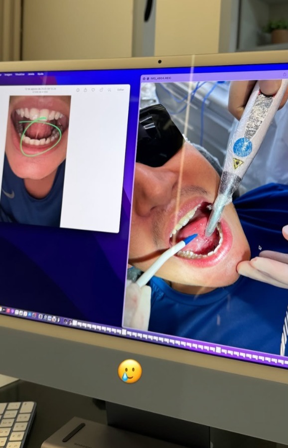 João Gomes faz cirurgia na língua por Reprodução/Instagram