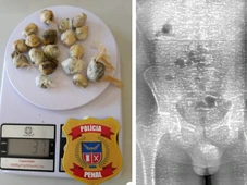 Imagem - Homem engole 18 'bolinhas' de maconha para entrar com drogas em presídio na Bahia