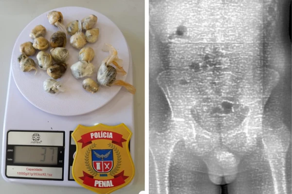 Homem engole 18 “bolinhas” de maconha para entrar com drogas em presídio na Bahia