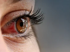 Imagem - 'AVC' nos olhos pode levar à perda total da visão, alertam médicos: 'É bem brutal'