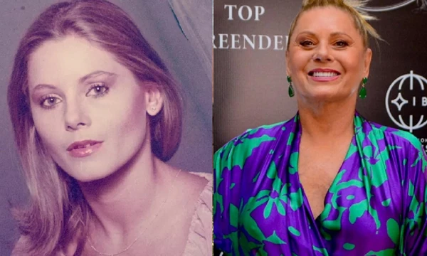 Antes e depois de Vera Fischer por Reprodução
