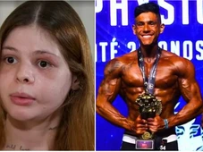 Imagem - Médica se fingiu de morta para escapar de espancamento do namorado fisiculturista: 'Senti a vida indo embora'
