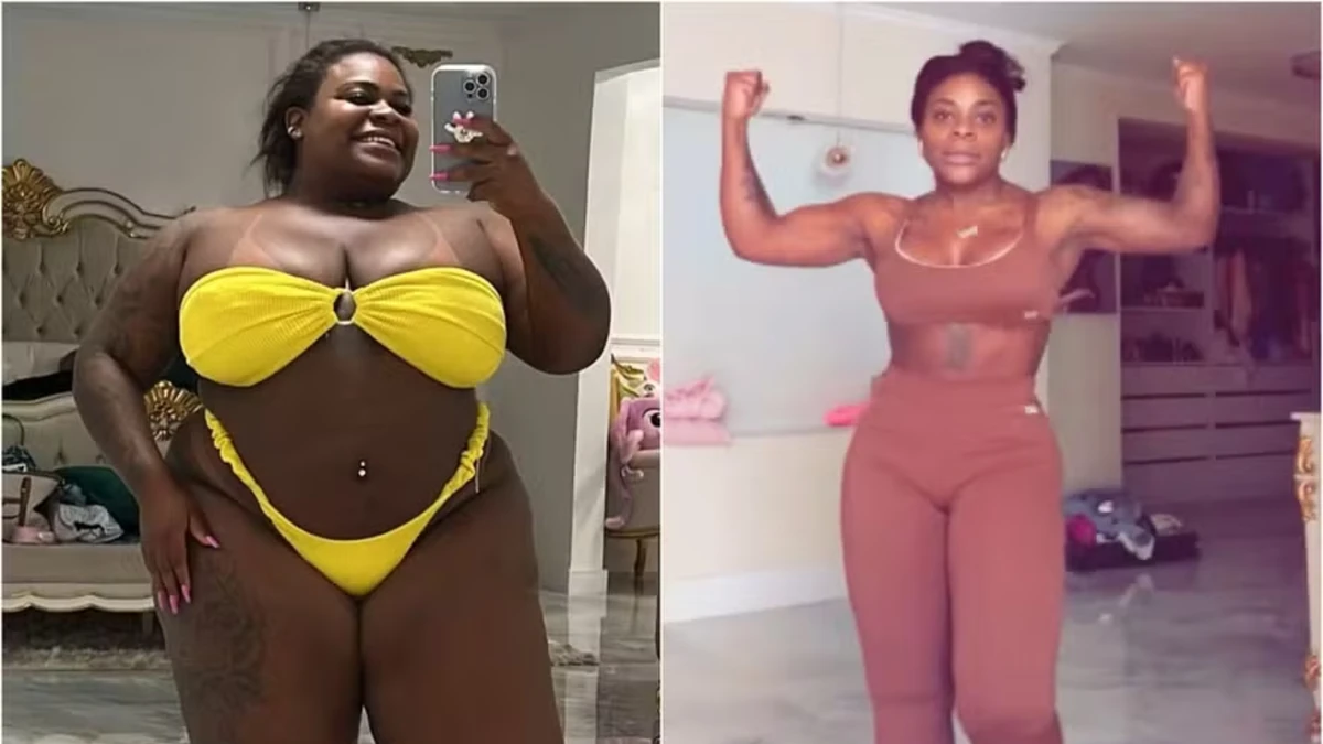 A cantora passou por cirurgia bariátrica, além de outros procedimentos para remover o excesso de pele resultante da perda de peso, como abdominoplastia e lipoaspiração. Também passou a adotar hábitos saudáveis e exercícios por Reprodução