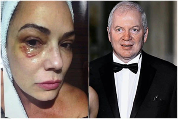 Luiza Brunet pede R$ 1 milhão de ex-marido por danos à carreira causados por agressão por Reprodução/Redes Sociais 