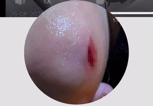 Corte de Ayla por Reprodução